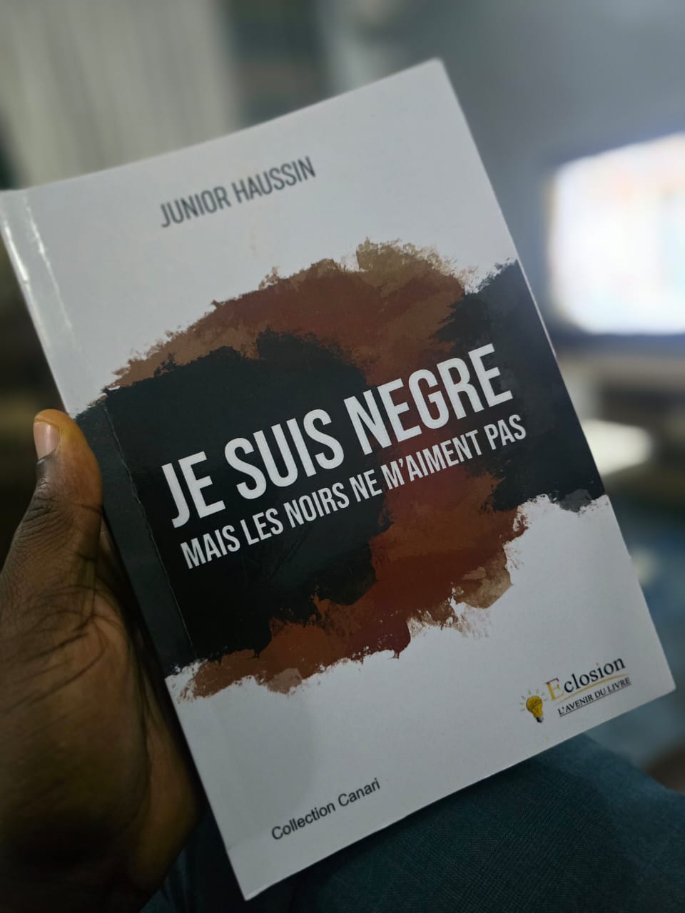 Teint noir, regards blessants : Junior Haussin brise un tabou en Afrique noire