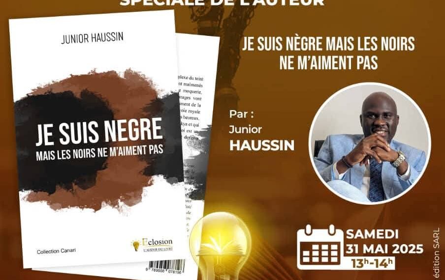 Teint  noir,  regards blessants : Junior Haussin brise un tabou en Afrique noire
