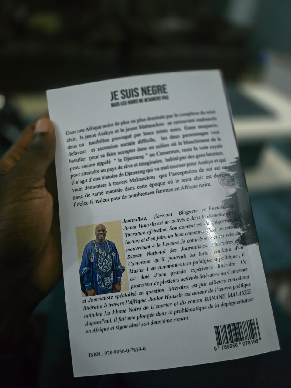 Teint noir, regards blessants : Junior Haussin brise un tabou en Afrique noire